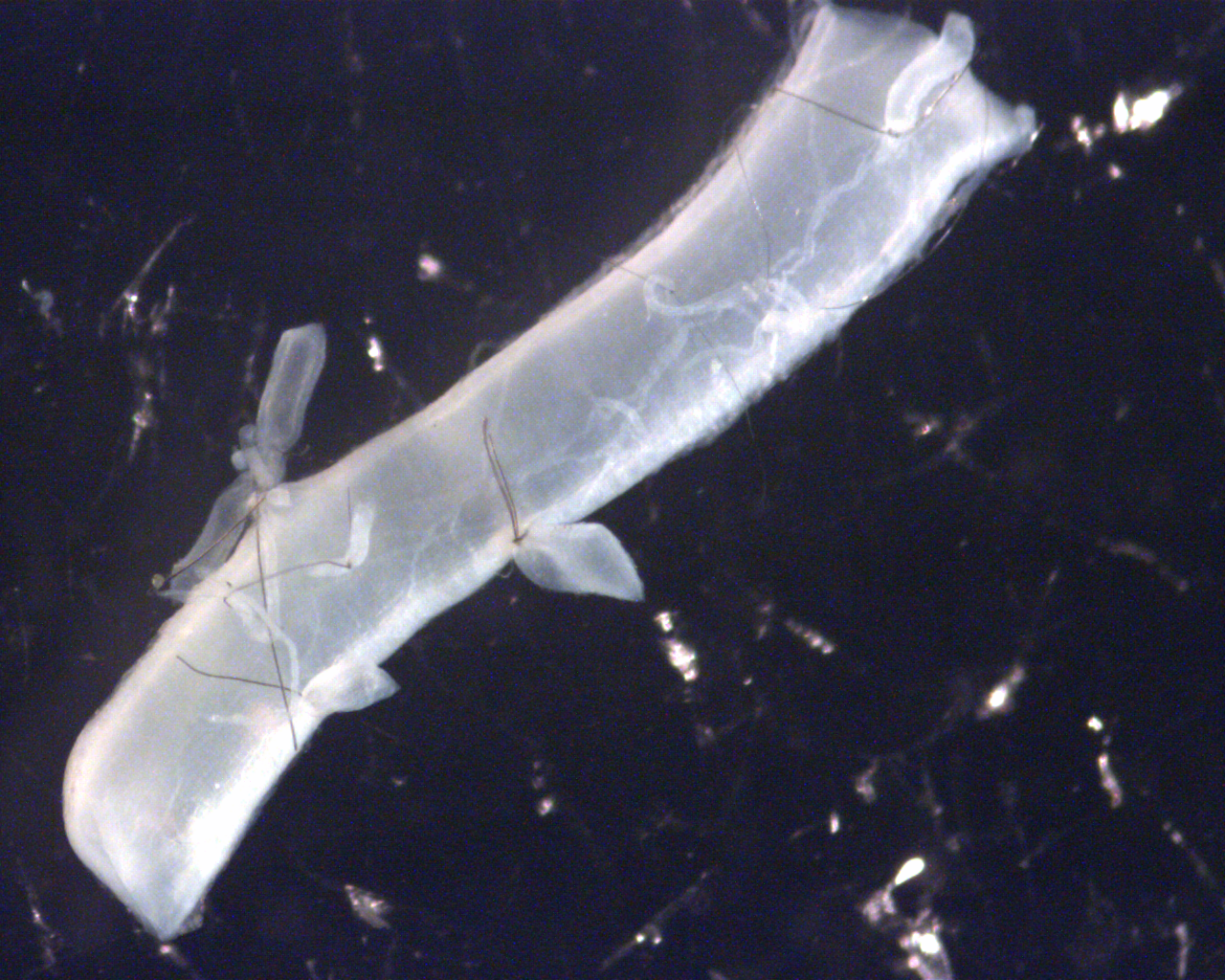 (Thesis) Analyzing the Softening Behavior of Brain Vessels